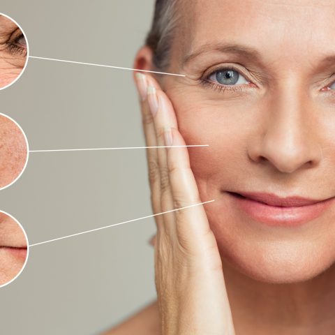 Anti aging. Wrinkles and skin imperfection