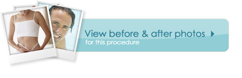 Removal & Replacement procedures