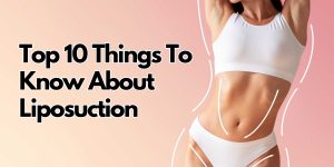 top 10 things to know about liposuction in Michigan