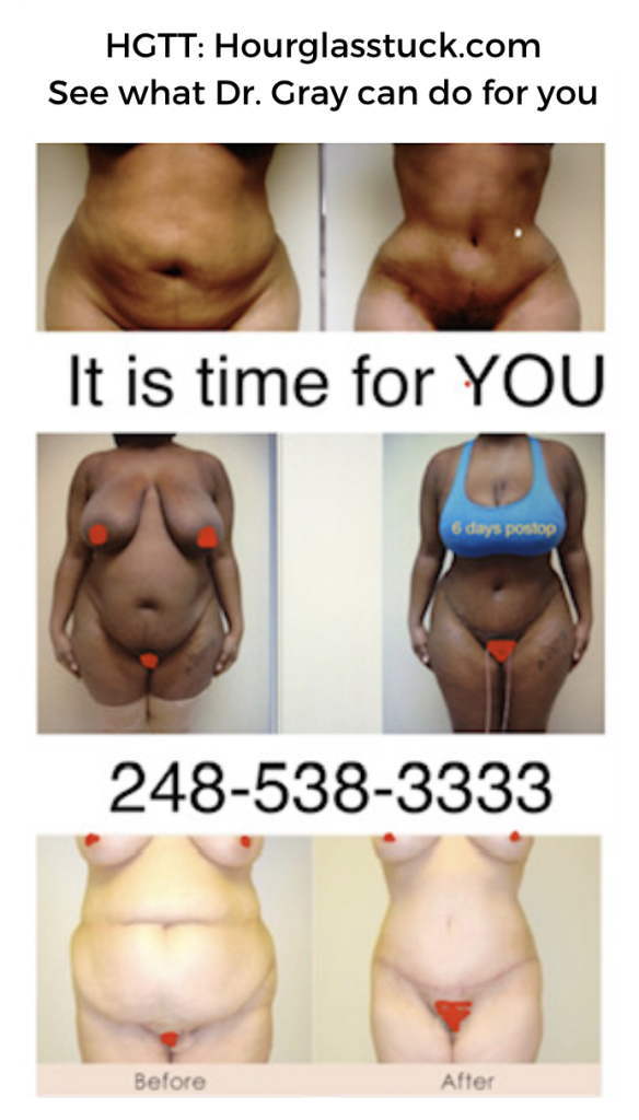 HGTT: Hour Glass Tuck - See what Dr. Gray can do for you!