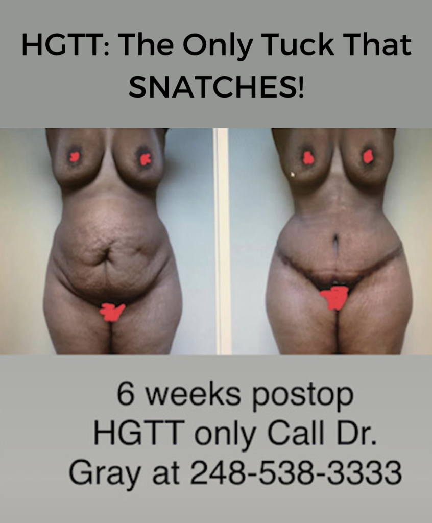 HGTT: The Only Tuck That SNATCHES!