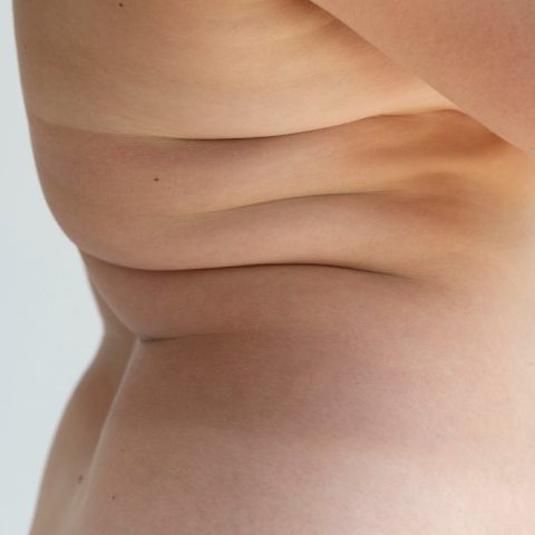 Fat Transfer - A New You