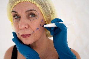 Mini Facelift - A New You
